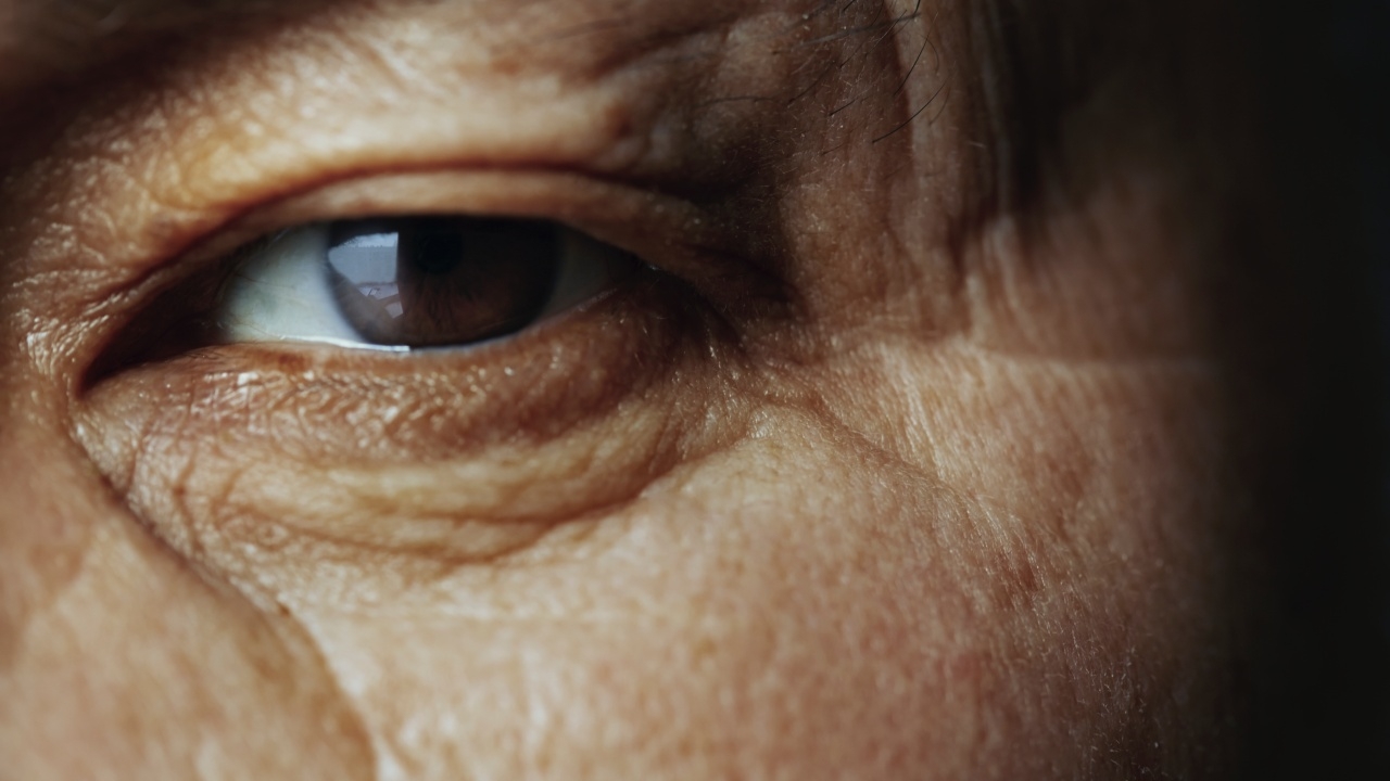 เบาหวานขึ้นตา หากไม่รีบรักษาอาจตาบอดได้