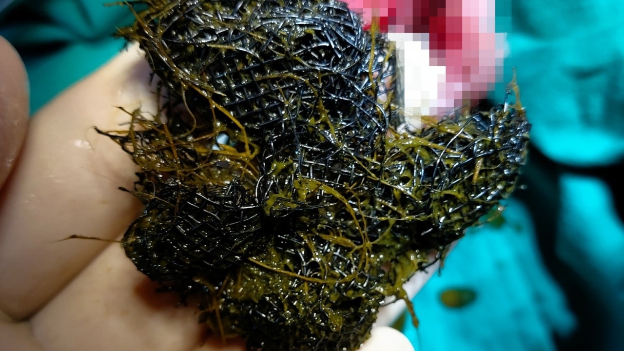 แมวถ่ายไม่ออก กินอะไรไม่ได้ร่วมเดือน หมอผ่าตัดด่วน เจอมุ้งลวดอุดตันในกระเพาะ