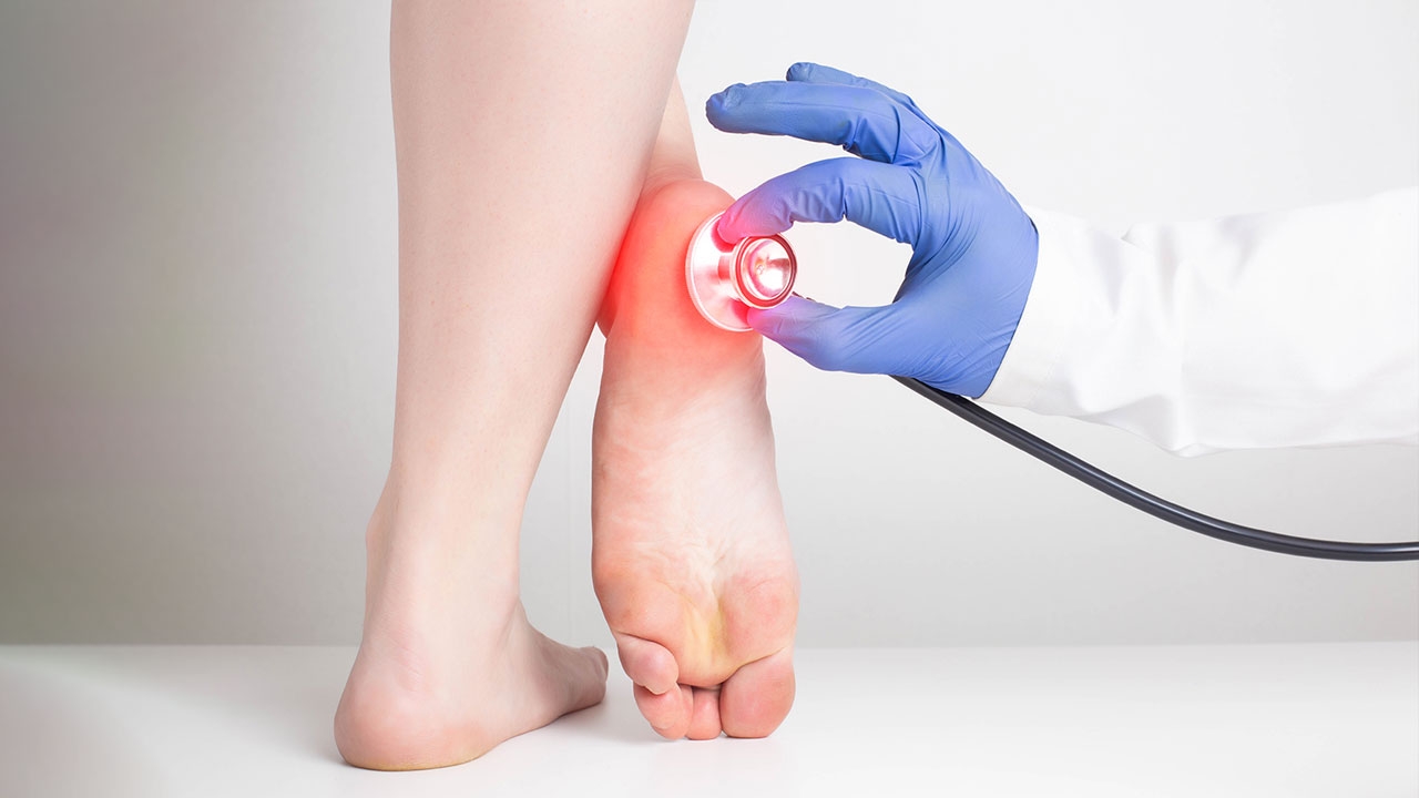 “ภาวะเท้าแบน” คืออะไร?