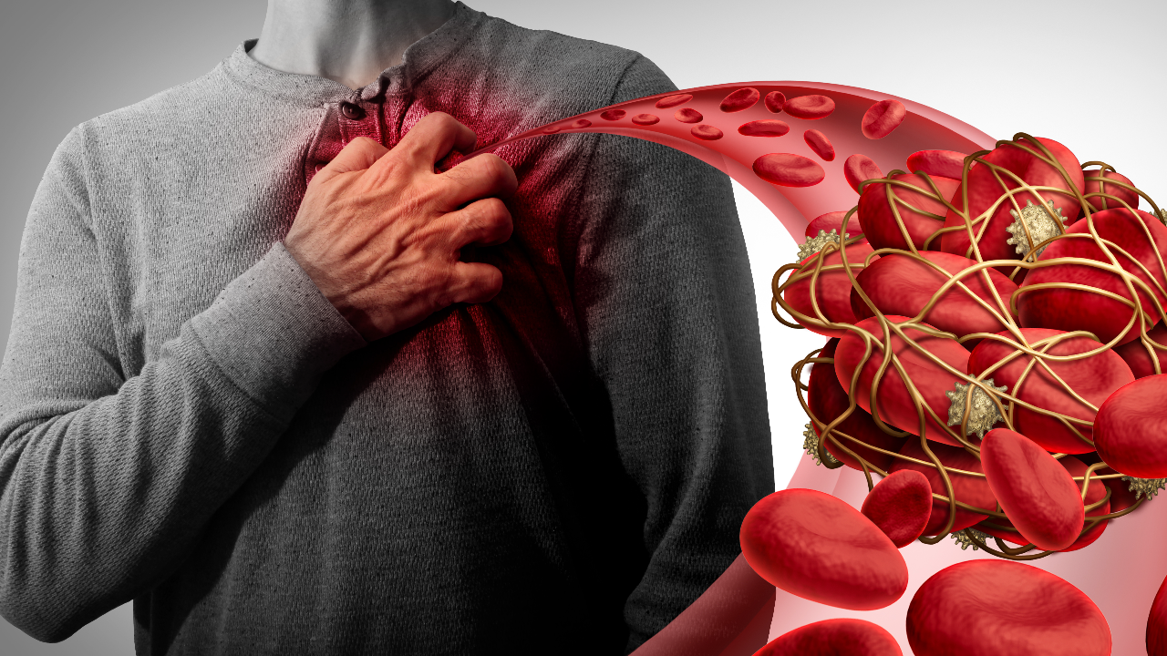 8 นาที กับ 8 ท่าบริหารร่างกายลดความเสี่ยงเกิดโรคหลอดเลือดอุดตัน 