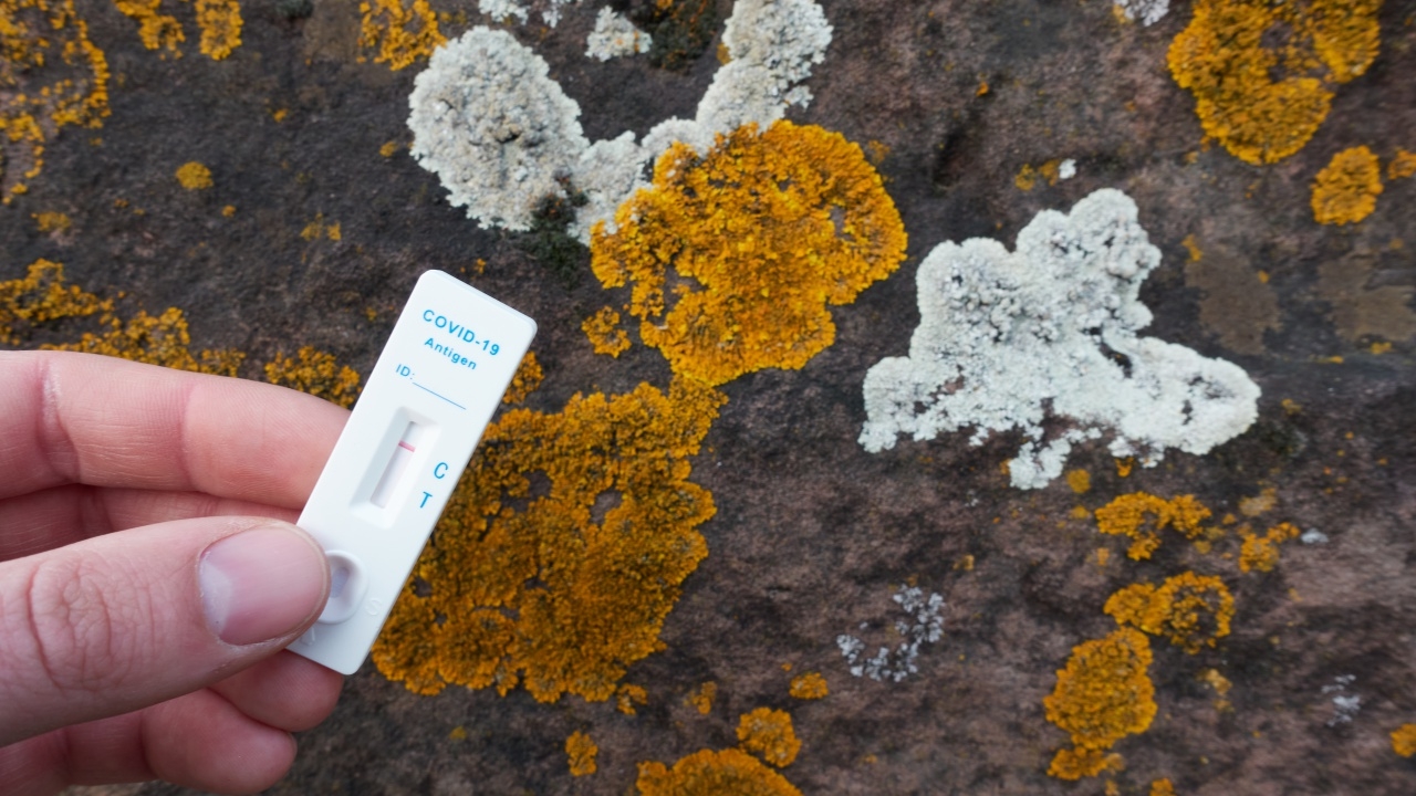 "หมอยง" เผย 8 อาการโรค "โควิด-19" เปลี่ยนไปจากเดิม ยังมีบางกลุ่มเสี่ยงสูง