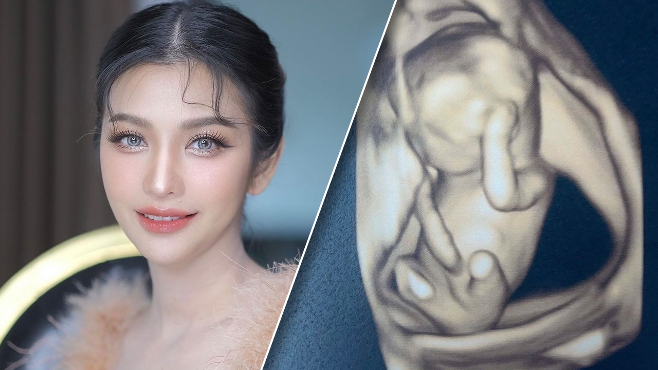 เซอร์ไพรส์ ลาล่า ประกาศข่าวดี หนูเล็ก บลูเบอร์รี่ กำลังตั้งท้อง