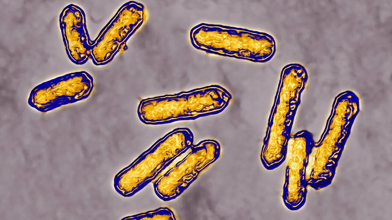 CDC เผย เชื้อลิสทีเรียระบาดใน 6 รัฐ ตายแล้ว 1 ศพ ป่วยอีกนับสิบ