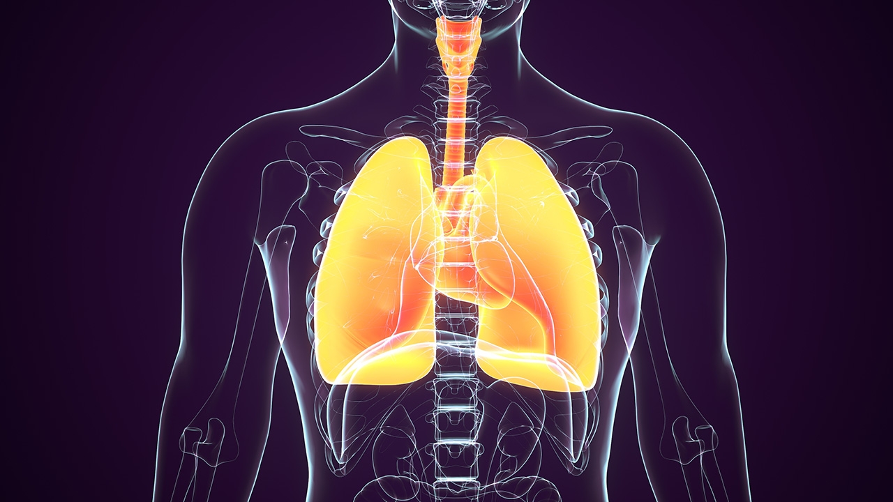 "ฮิสโตพลาสโมซิส" ปอดอักเสบจากเชื้อรา