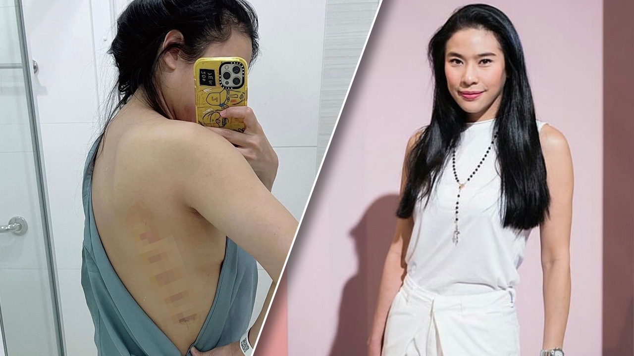 ครี พัสวีพิชญ์ เปิดคลิปเป็นอุทาหรณ์ลื่นล้มเจ็บหนักต้องเรียกรถพยาบาล (คลิป)