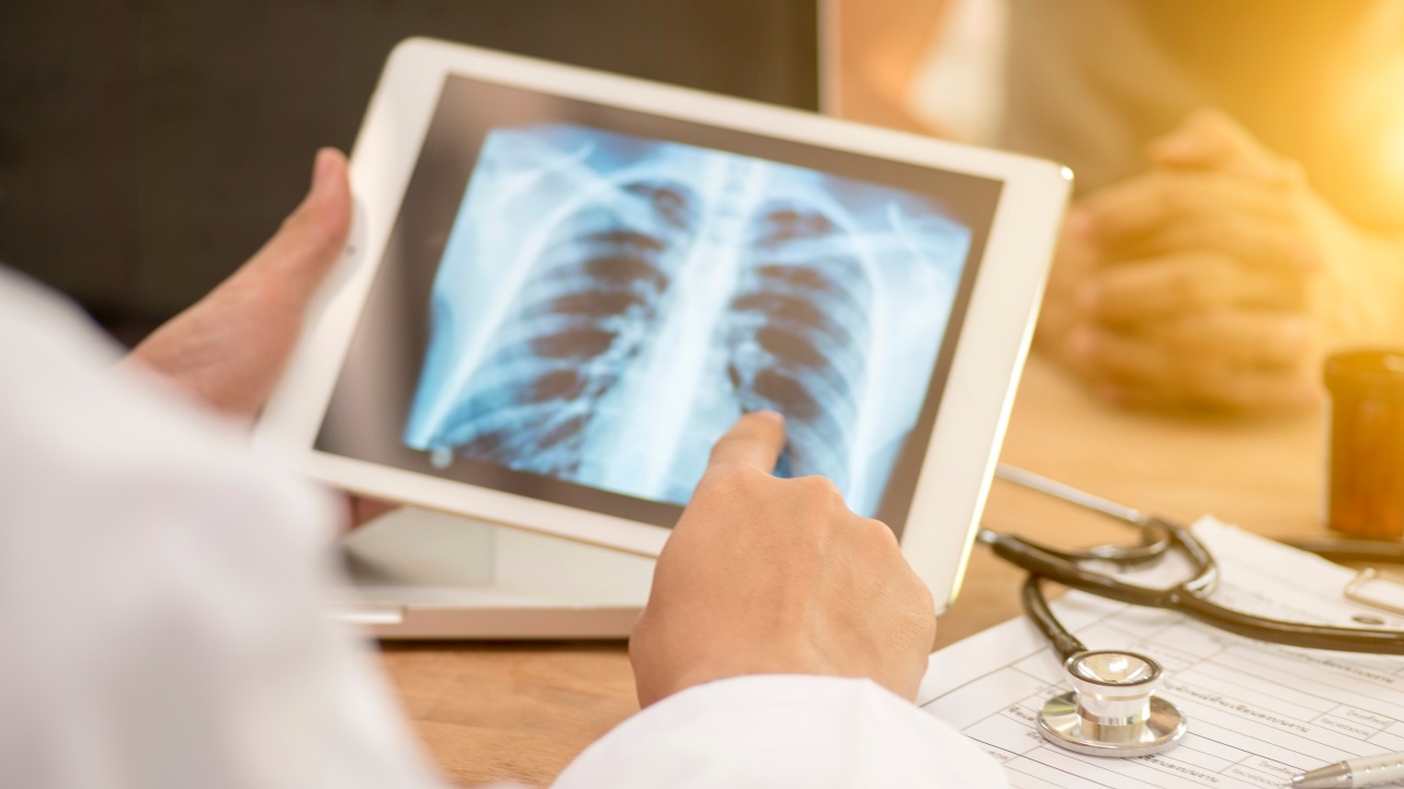 "หมอมนูญ" เผย "เชื้อโควิด" ในร่างกาย ทำให้ปอดอักเสบซ้ำอีกได้ แม้จะหายป่วยแล้ว