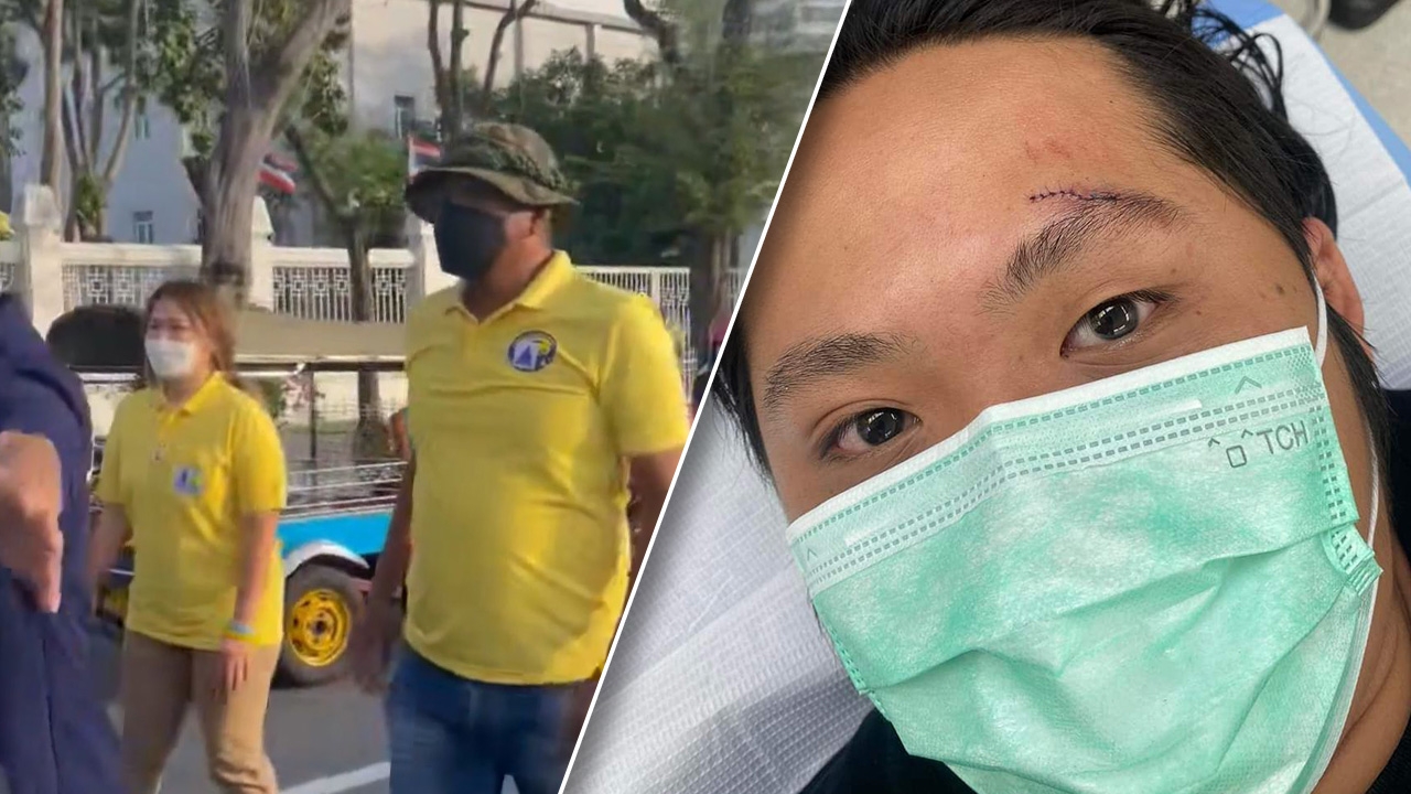 “อานนท์” อ้างทำร้าย “สายน้ำ ทะลุวัง” ปกป้องมวลชน แต่กลับถูกพวกเดียวกันด่ายับ