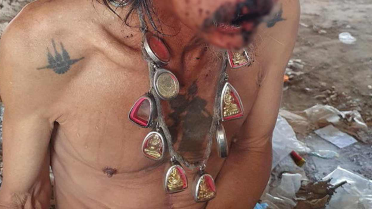 หนุ่มใหญ่ห้อยพระเต็มคอ โดนซ้อมหน้าแตกยับไม่เหลือเค้าเดิม