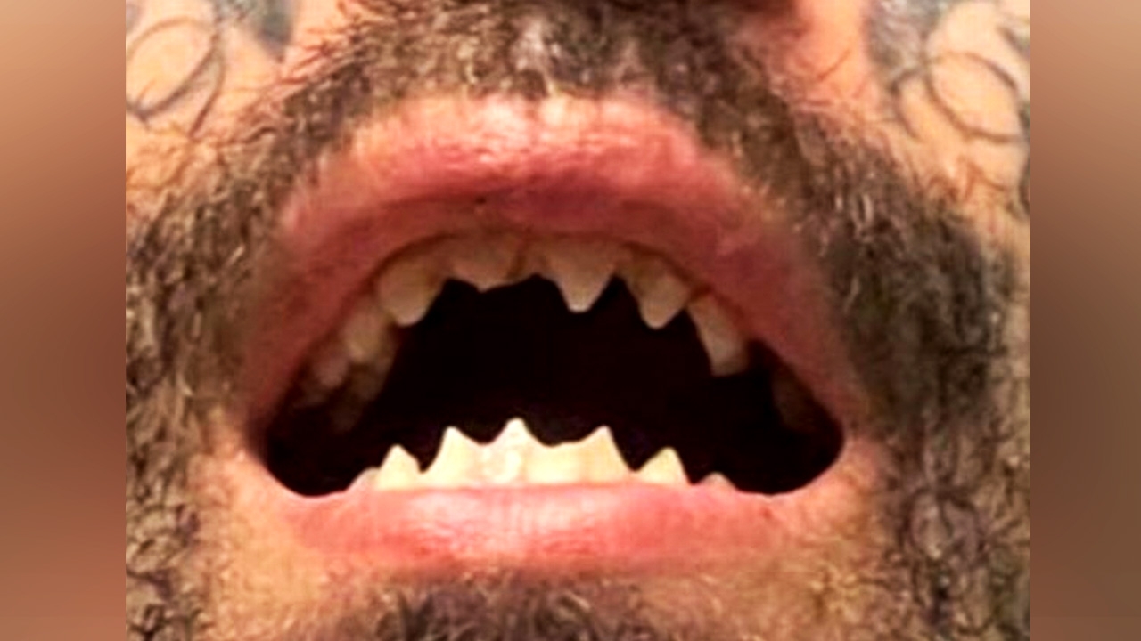 สยอง ชายฟันแหลมเหมือนฉลาม ในสหรัฐฯ โดนจับ กักขังสาวตั้งครรภ์ เป็นทาสกาม 