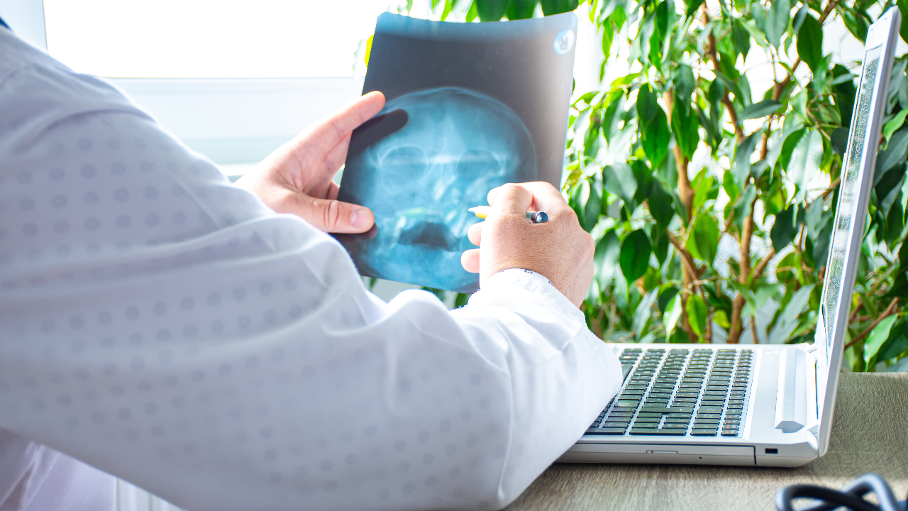 รู้จัก “มะเร็งโคนลิ้น” สาเหตุและอาการเป็นอย่างไร รักษาได้หรือไม่ 