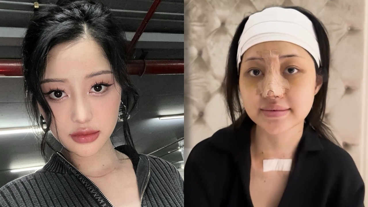 มิ้วกี้ ไปรยา รีวิวอัปหน้าใหม่ ผ่านไป 14 วัน แฟนๆ ชมสวยปังมาก (คลิป)