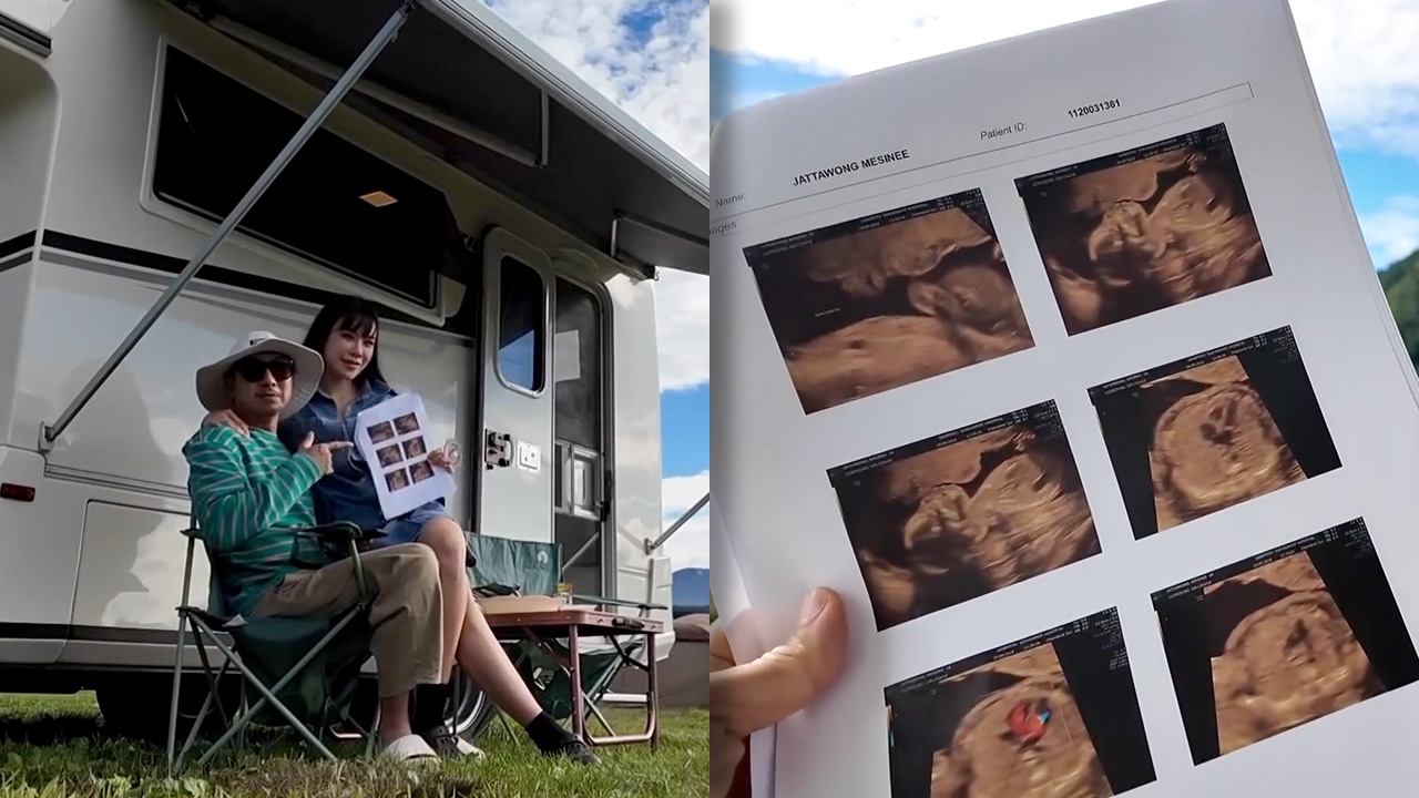 โจอี้ บอย เฮ! เตย เมษินี ท้องแล้ว เปิดภาพอัลตราซาวนด์ลูกคนแรก (คลิป)