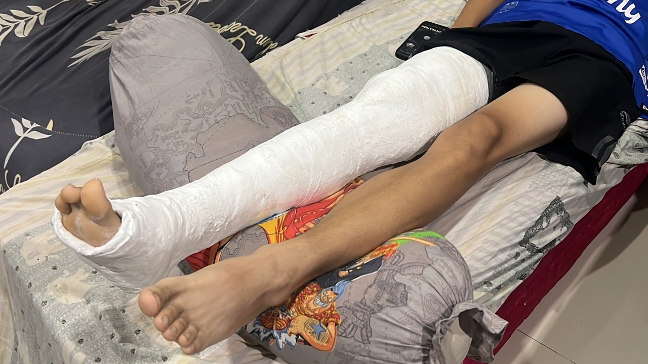 พ่อร้อง ลูก ม.2 ถูกเพื่อนทุ่มลงพื้น เข่าแตก คู่กรณีจะจ่ายแค่ 5,000 บาท