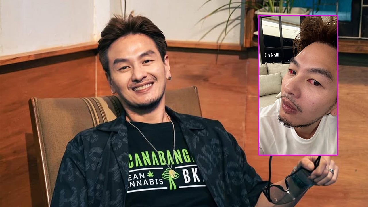 แฟนๆ ส่งกำลังใจ หลัง บีม ศรัณยู เจอพิษ PM 2.5 ตาขาวแดงก่ำจนน่ากลัว 