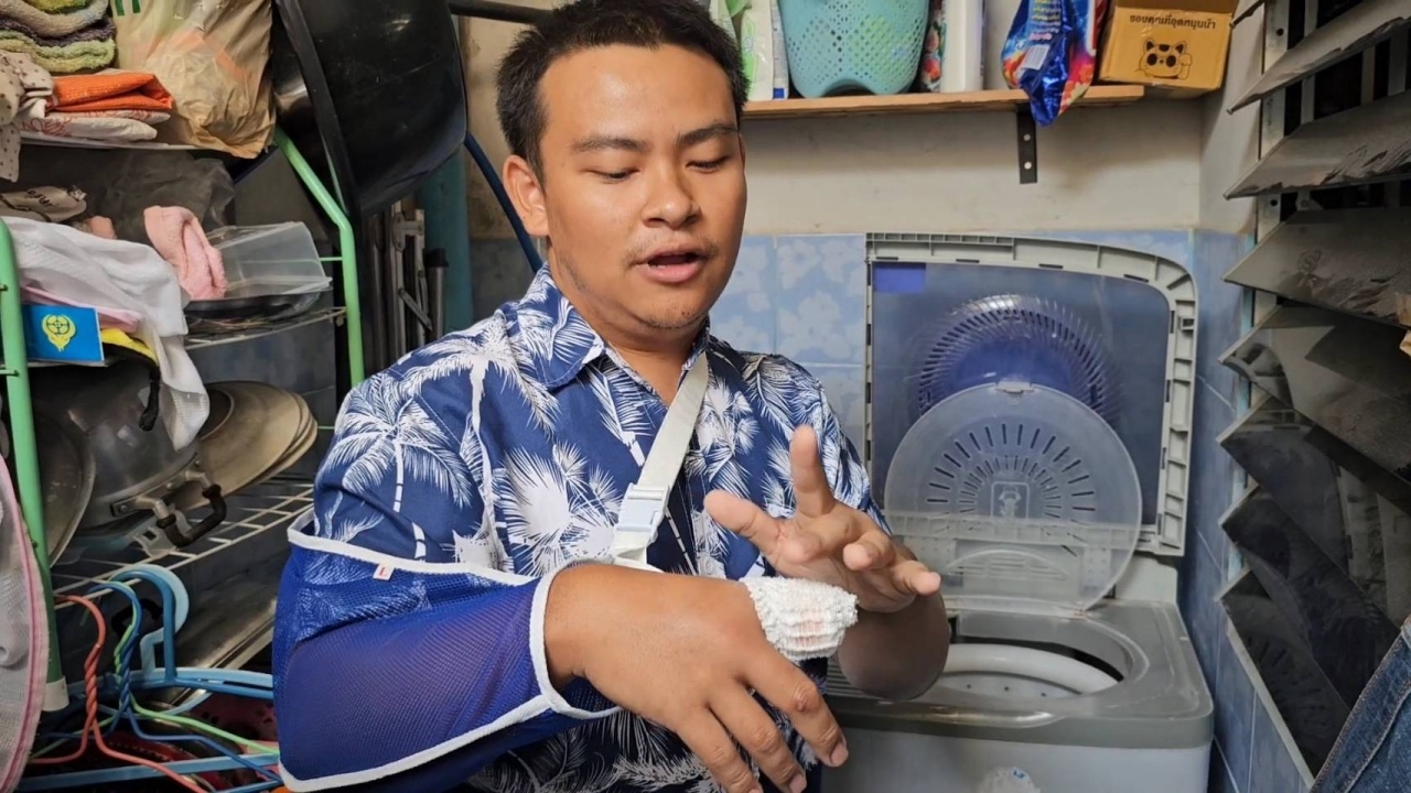 หนุ่มแชร์อุทาหรณ์ เปิดฝาถังเครื่องซักผ้าตอนยังไม่หยุดหมุน สุดท้ายโดน "ตัดนิ้ว"