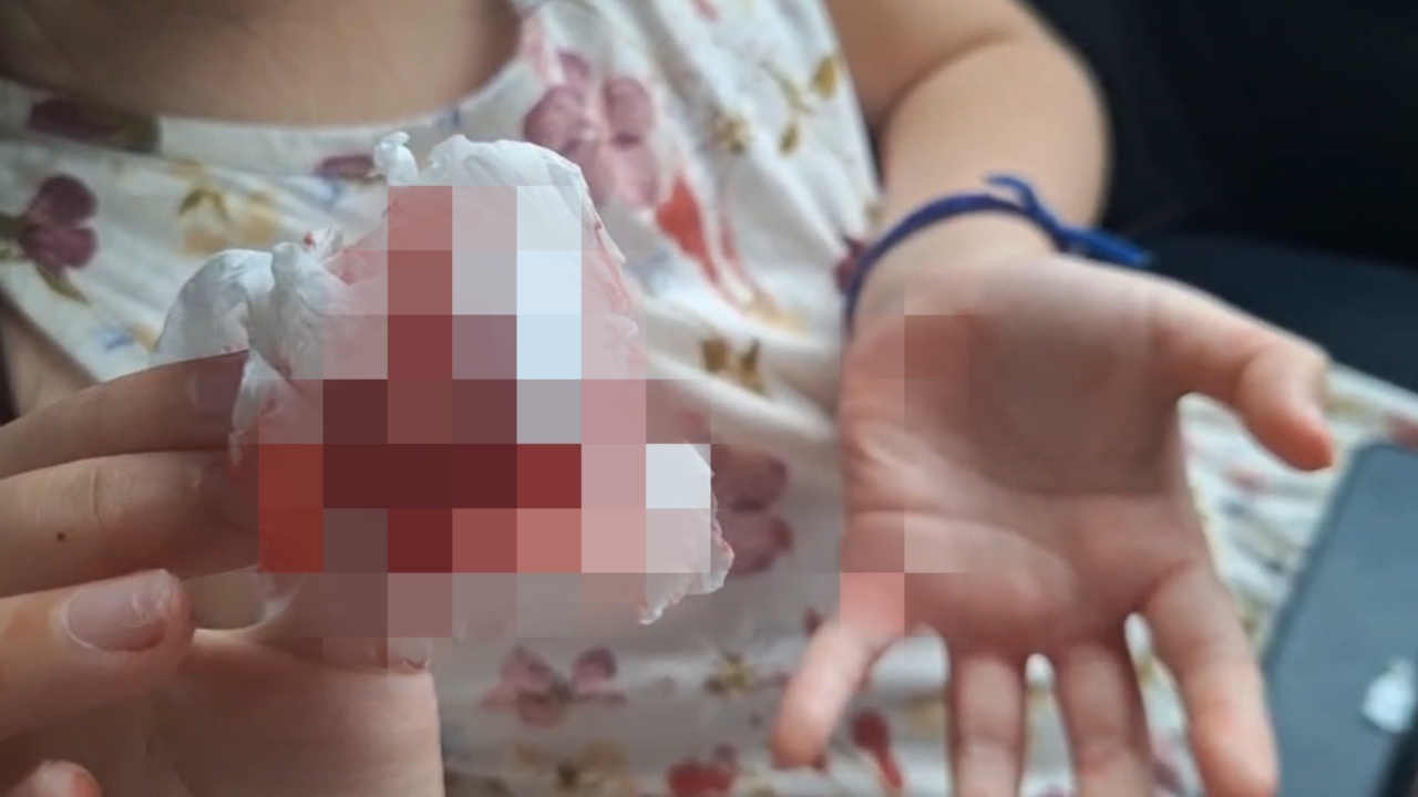 "ฝุ่นเชียงใหม่" ยังพุ่ง พ่อสุดห่วงลูกสาว 7 ขวบ เลือดกำเดาไหลหนักกว่าทุกปี