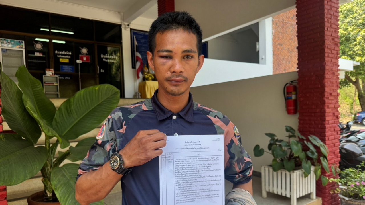 ทุบเจ้าหน้าที่พิทักษ์ป่า เบ้าตาบวมปิด ฉุนถูกเตือนอย่าจุดไฟเผาป่า ยันเอาผิดถึงที่สุด