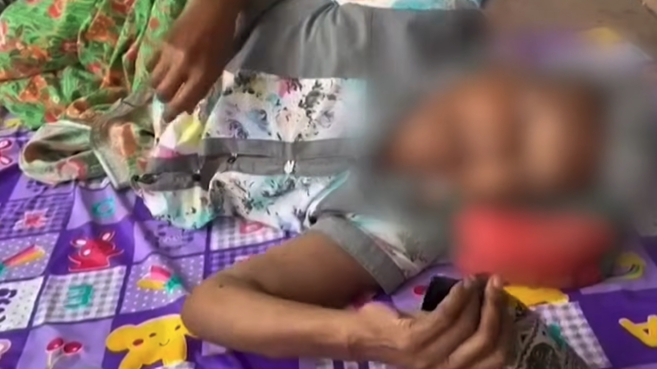 เวทนา ยายวัย 76 ปี โดนทิ้งนอนข้างถนน ป่วย-โดนมดกัด ลูกหลานอ้างไม่มีทางเลือก