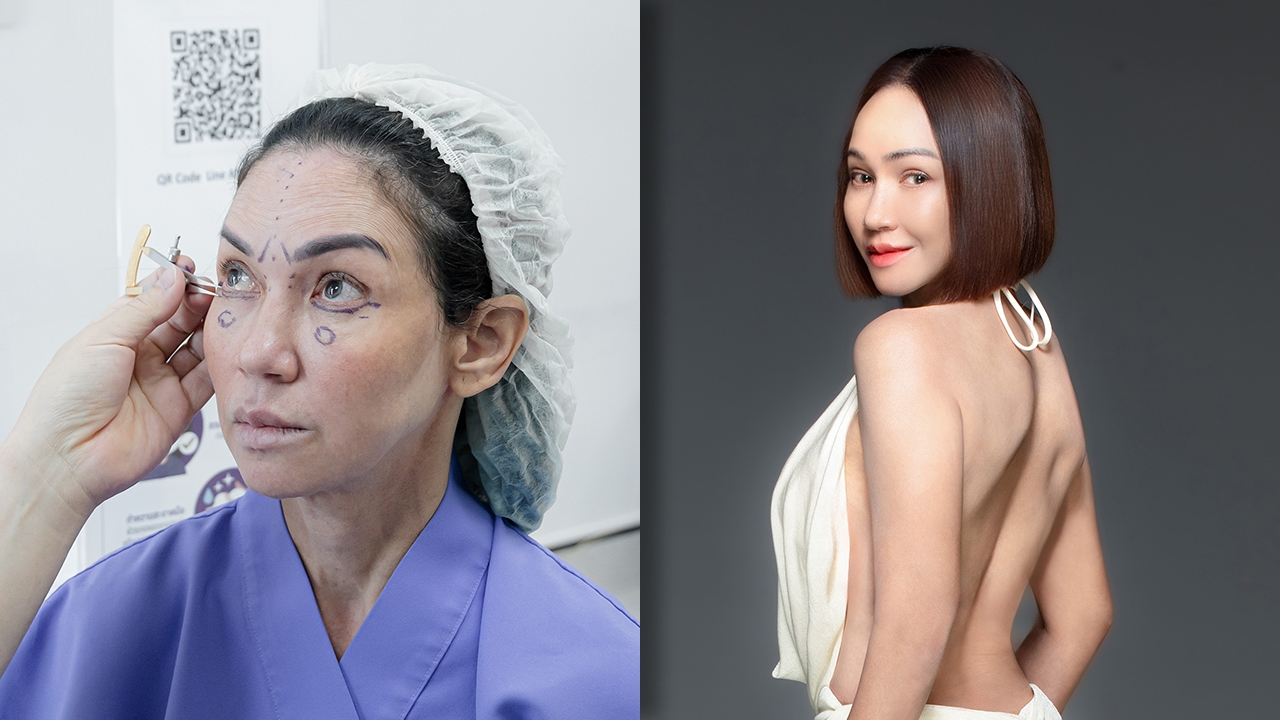 ดี้ ปัทมา เผยเบื้องหลังศัลยกรรม 8 ช.ม. ผ่า 6 จุด กว่าจะสวยเลือกหมอเกือบ 10 ปี