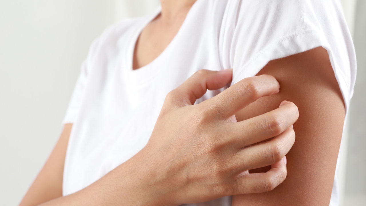 เตือนผู้สูงวัยเสี่ยงป่วยโรคงูสวัด แพทย์เตือนควรฉีดวัคซีนก่อนเกิดอาการรุนแรงและภาวะแทรกซ้อน