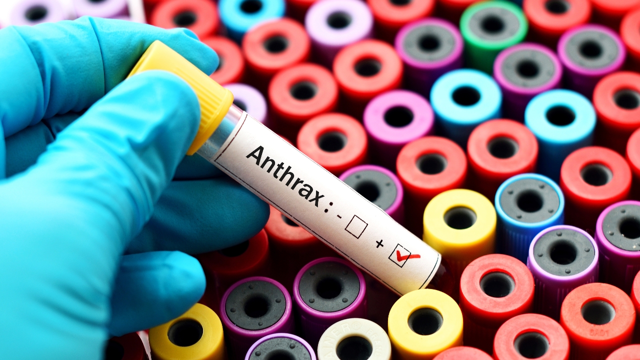 เปิดอาการ "แอนแทรกซ์" เกิดจากอะไร ป้องกันได้หรือไม่