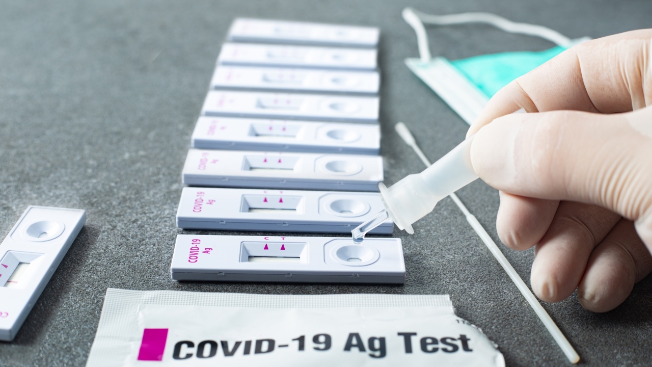 กรมควบคุมโรค เผยยอด "ผู้ป่วยโควิด" มีแนวโน้มลดลง ยันไม่พบการระบาดแบบกลุ่มก้อน