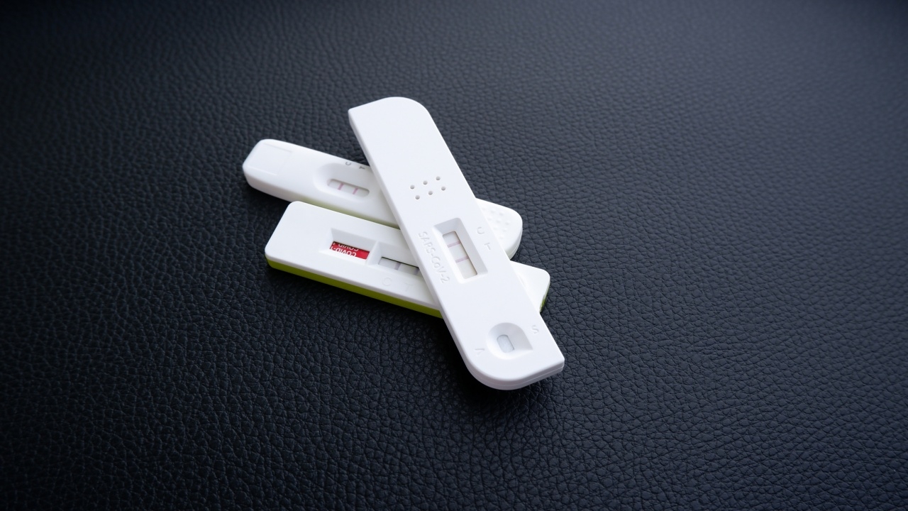 "หมอยง" ชี้ "โควิด-19" กำลังระบาดในประเทศไทย ส่วนใหญ่เป็นสายพันธุ์ XEC