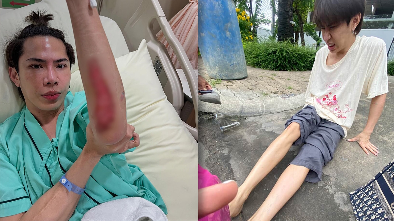 เอม วิทวัส เล่าประสบการณ์เฉียดตาย เผยภาพนาทีชีวิตหลังเกิดอุบัติเหตุมอเตอร์ไซค์ 