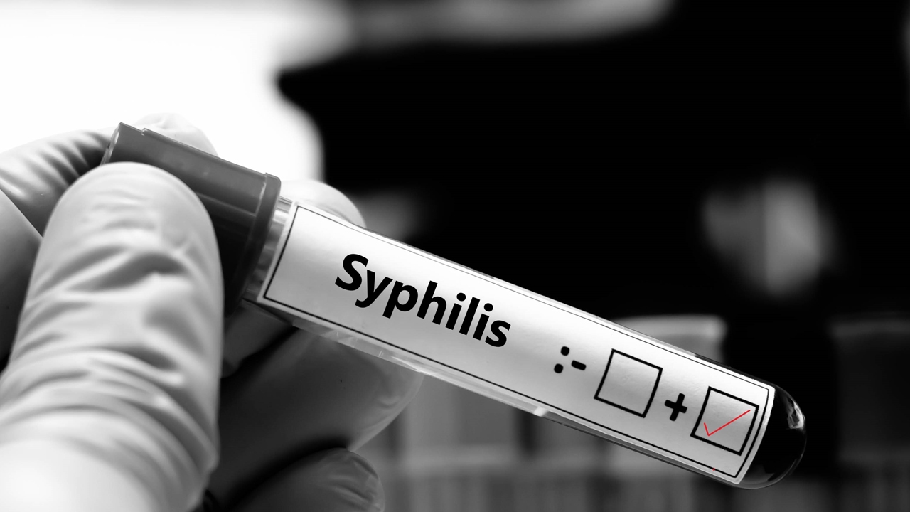 ผวาโรคติดต่อทางเพศสัมพันธ์พุ่ง “ซิฟิลิส-หนองใน” ไม่ใส่ถุงยาง