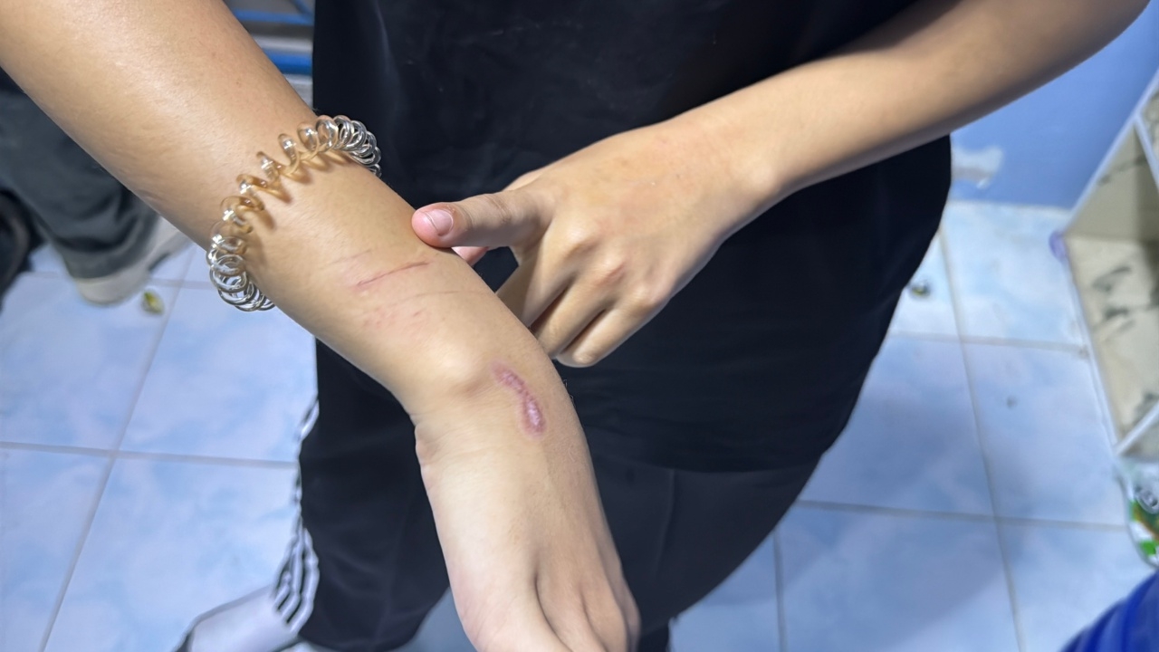ล่าคนร้าย อ้างตัวเป็นสายตำรวจ ลวงเด็กสาววัย 14 เข้าป่ากล้วย โชคดีรอดมาได้