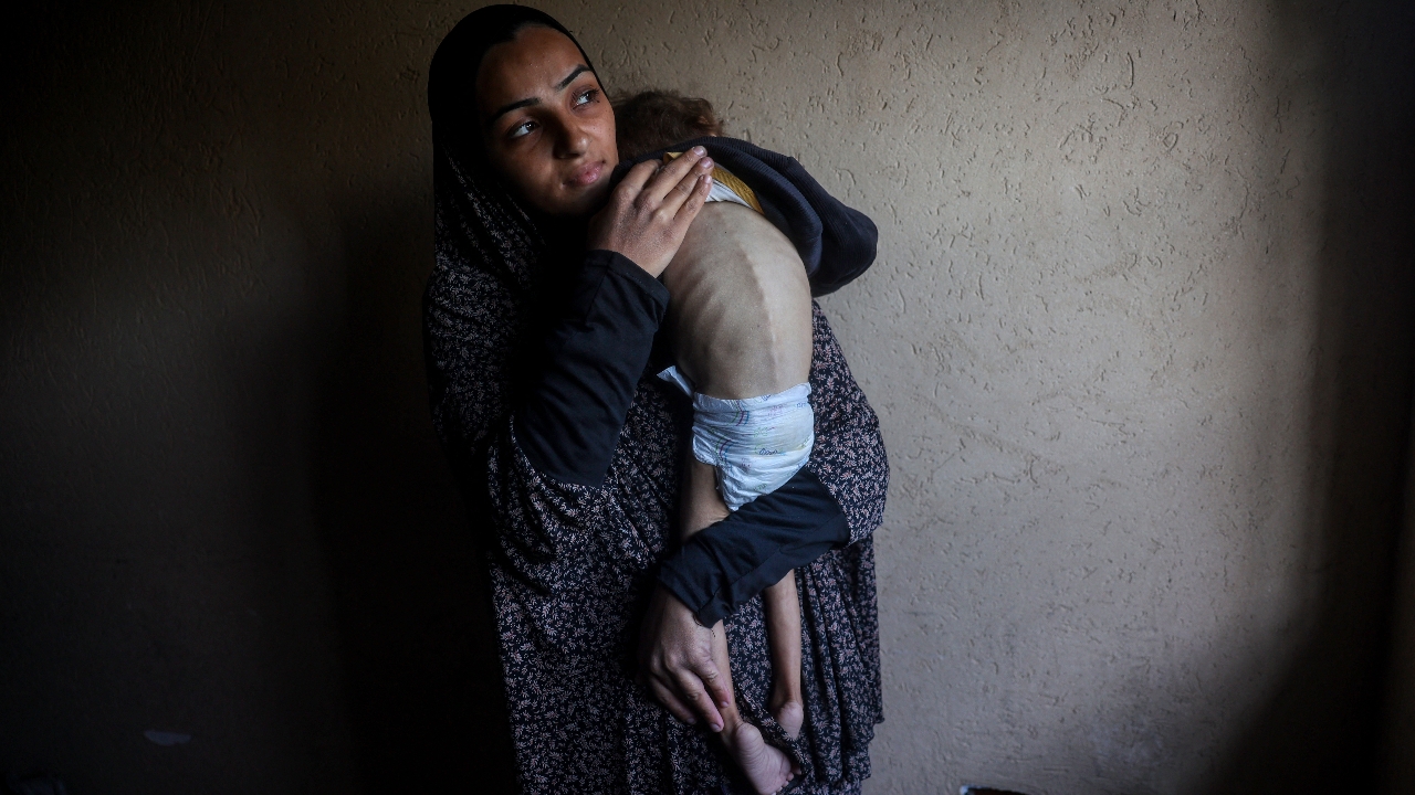 สลด เด็กน้อยปาเลสไตน์ 4 ขวบ เป็นโรคขาดอาหารรุนแรงจนเสียชีวิต หลังอิสราเอลเดินหน้าปิดล้อมฉนวนกาซา