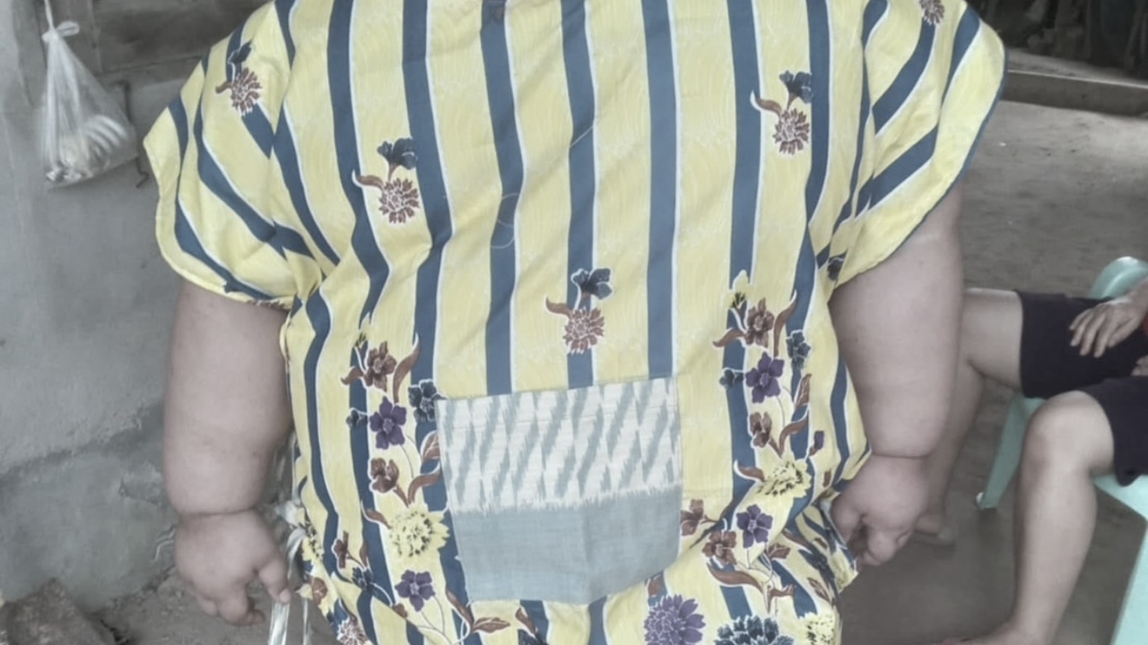 สุดเศร้า "น้องภูมิ" เด็กชายออทิสติก ป่วยโรคอ้วน เสียชีวิตแล้ว