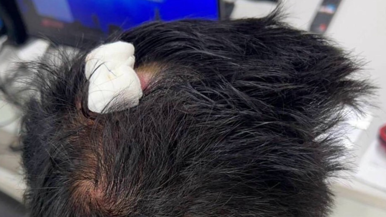 ผกก.สภ.ร่อนพิบูลย์ ทำหนังสือรายงานคดีดัง ส.ส.เมืองคอน รุมทืบผู้รับเหมากลางงานบวช