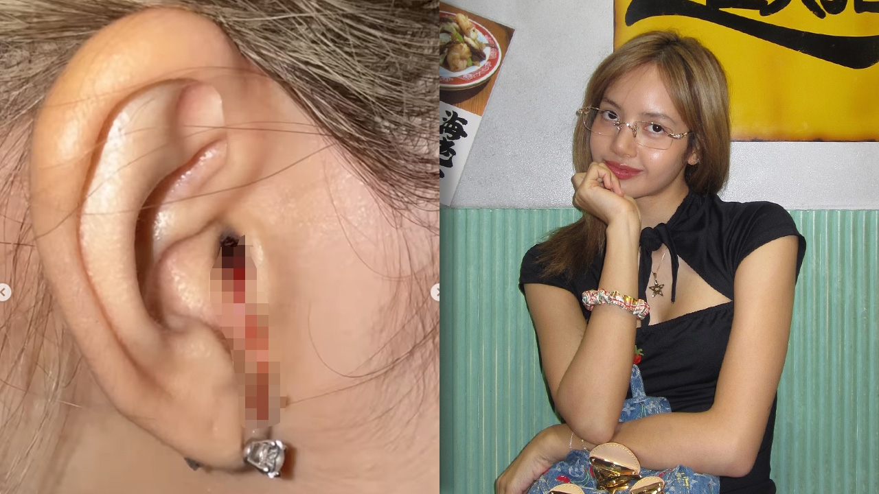 แฟนคลับทั่วโลกเป็นห่วง ลิซ่า หลังเห็นภาพคล้ายเลือดออกหู พากันถามเกิดอะไรขึ้น?