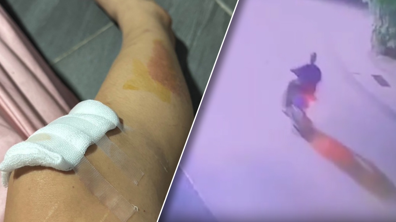 ออกหมายจับคนร้ายถีบรถสาวนักศึกษาผู้ช่วยพยาบาลหวังข่มขืน ยังหลบหนี