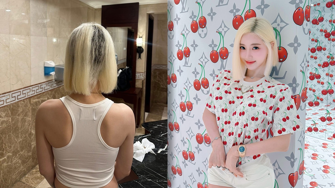 ดีเจโซดาสุดช็อก ทำสีผมแต่ร้านฟอกทิ้งไว้นานจนผมร่วงหนักถึงขั้นต้องโกนทิ้ง