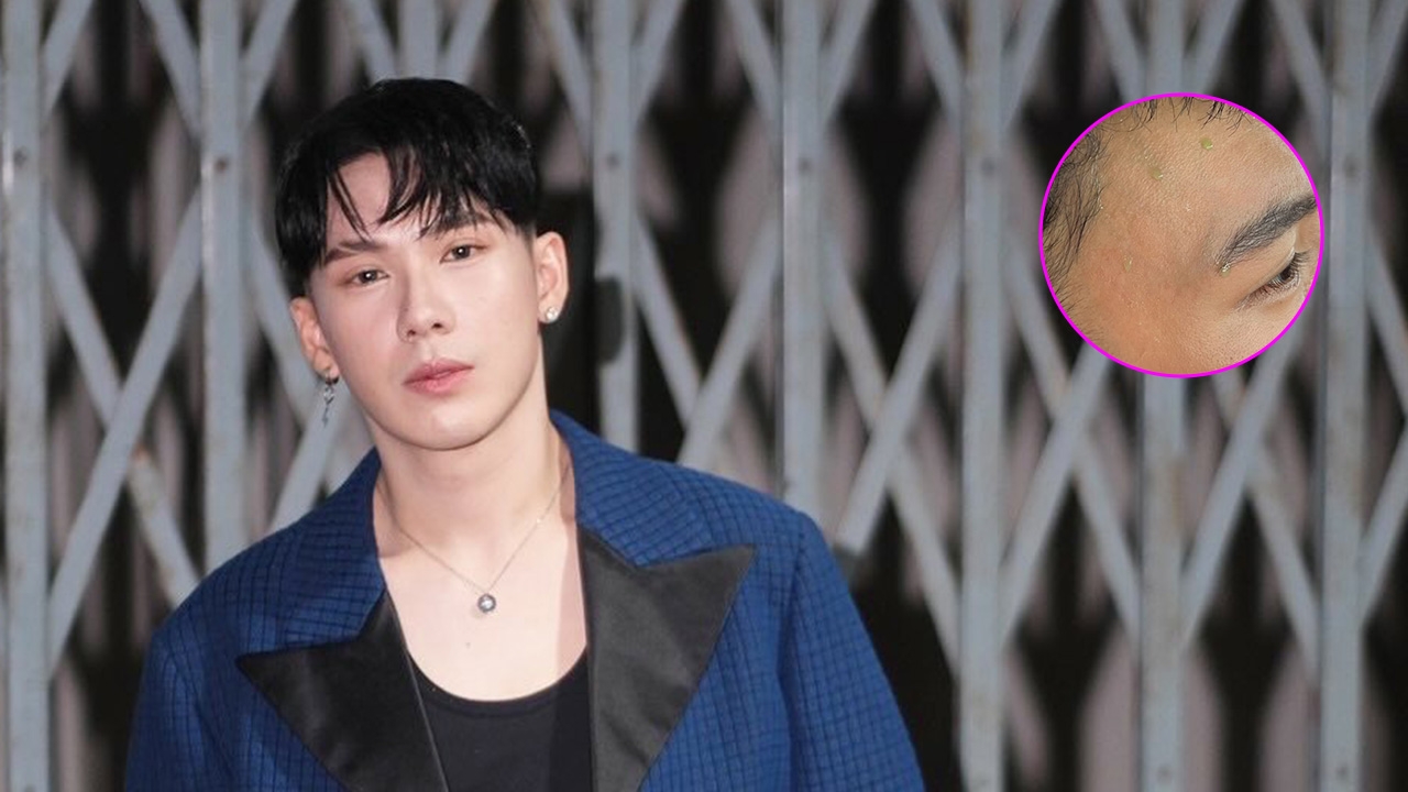 ตั้ม วราวุธ ตกใจหลังมีเหงื่อสีเขียว ถาม ChatGPT ทำเอาอึ้ง ก่อนได้คำตอบจากหมอ