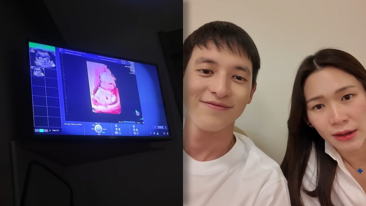 เปิด 3 สิ่งที่ โฟม ภรรยา เจมส์ จิรายุ ตั้งใจจะทำเมื่อรู้ว่ามีลูกขอลองก่อนถ้าไม่ไหวก็ไม่ฝืน