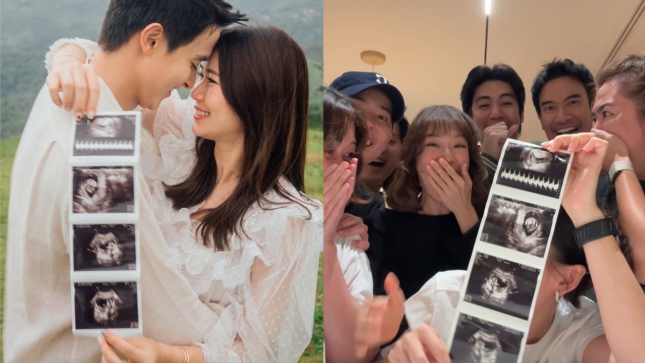 เบบี๋มาแล้ว เจมส์จิ-โฟม โชว์ภาพอัลตราซาวด์ เฉลยตัวละครลับ เพื่อนดาราแห่ยินดี