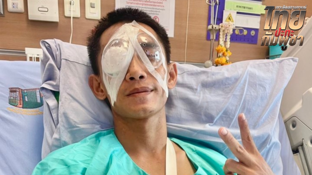 “สิบเอกสุทธิชัย” นักรบตาควาย ผ่าตัดตารอบ 4 หมอนำสะเก็ดที่ลึกที่สุดออกมาได้ด้วยดี