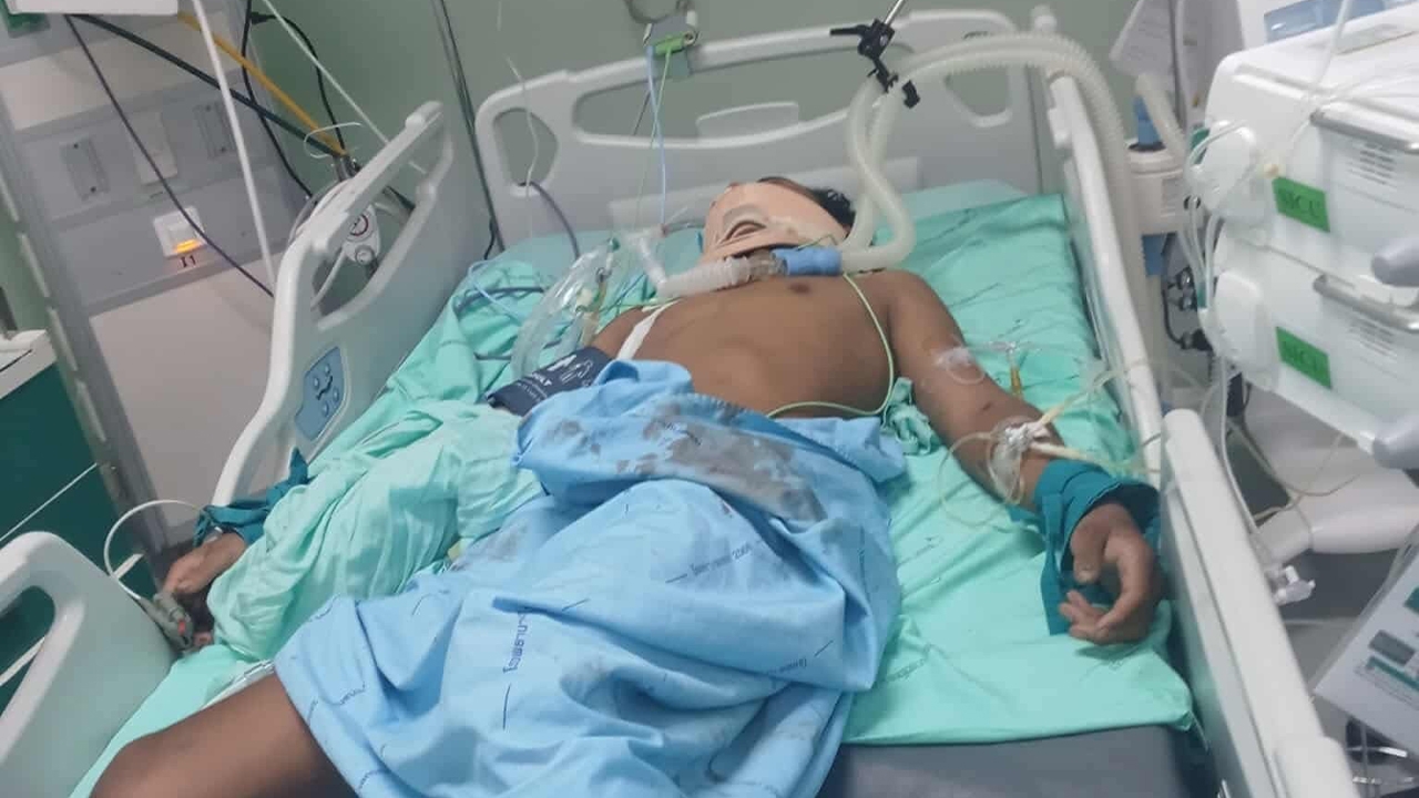 "นักมวยไทย" ประสบอุบัติเหตุ อาการสาหัส เข้ารักษา ICU