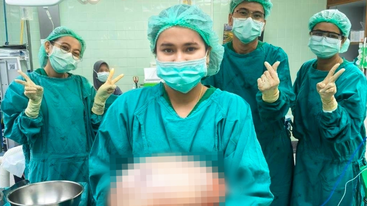 หมอผ่าตัดซีสต์รังไข่ หนัก 8 กก. แม่แปลกใจคิดว่าลูกท้องป่องเพราะกินเยอะ