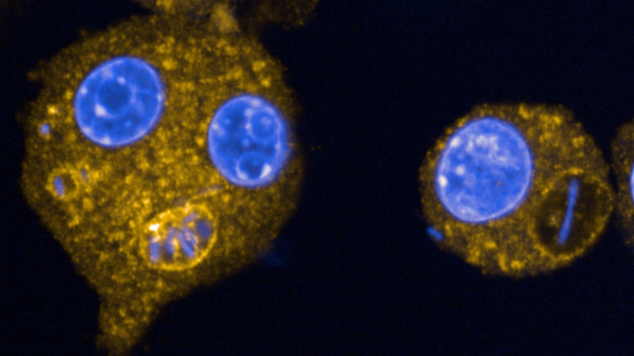 แอริโซนาพบผู้เสียชีวิตจาก “กาฬโรคปอด” ยืนยันความเสี่ยงต่อสังคมต่ำ