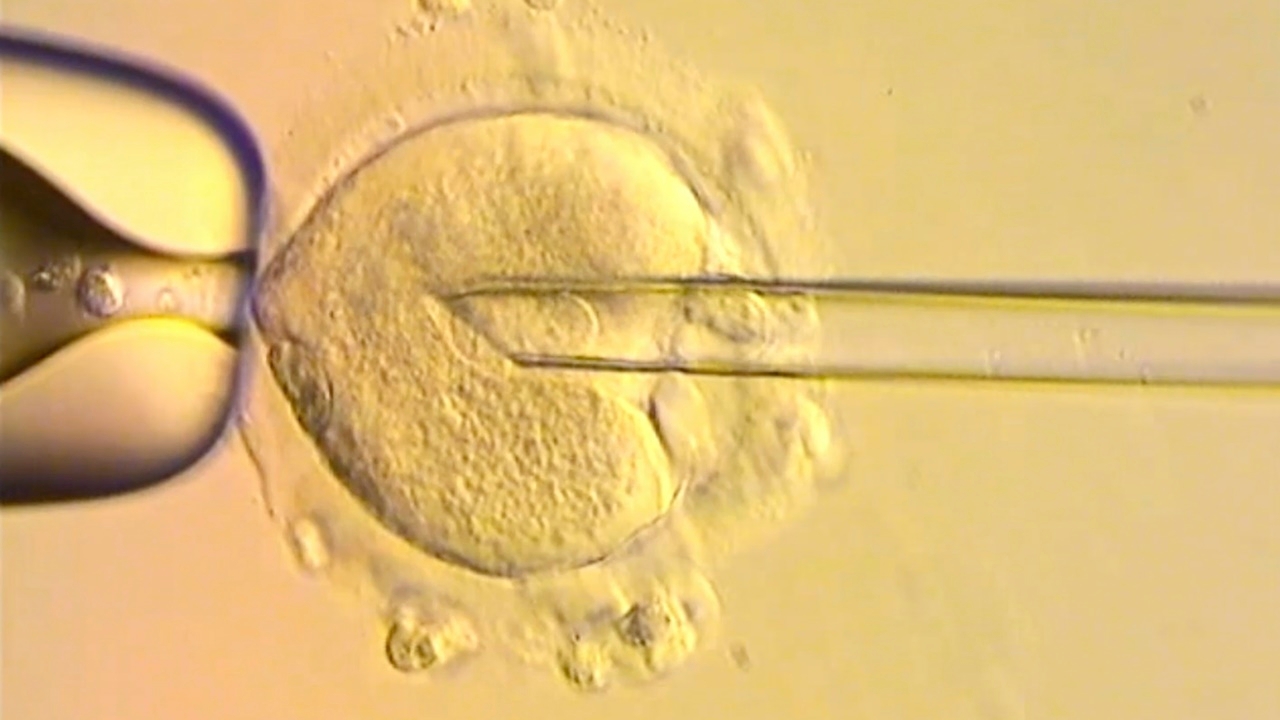 นักวิทย์ใช้ DNA จากคน 3 คน ให้กำเนิดทารกปลอดโรคทางพันธุกรรม