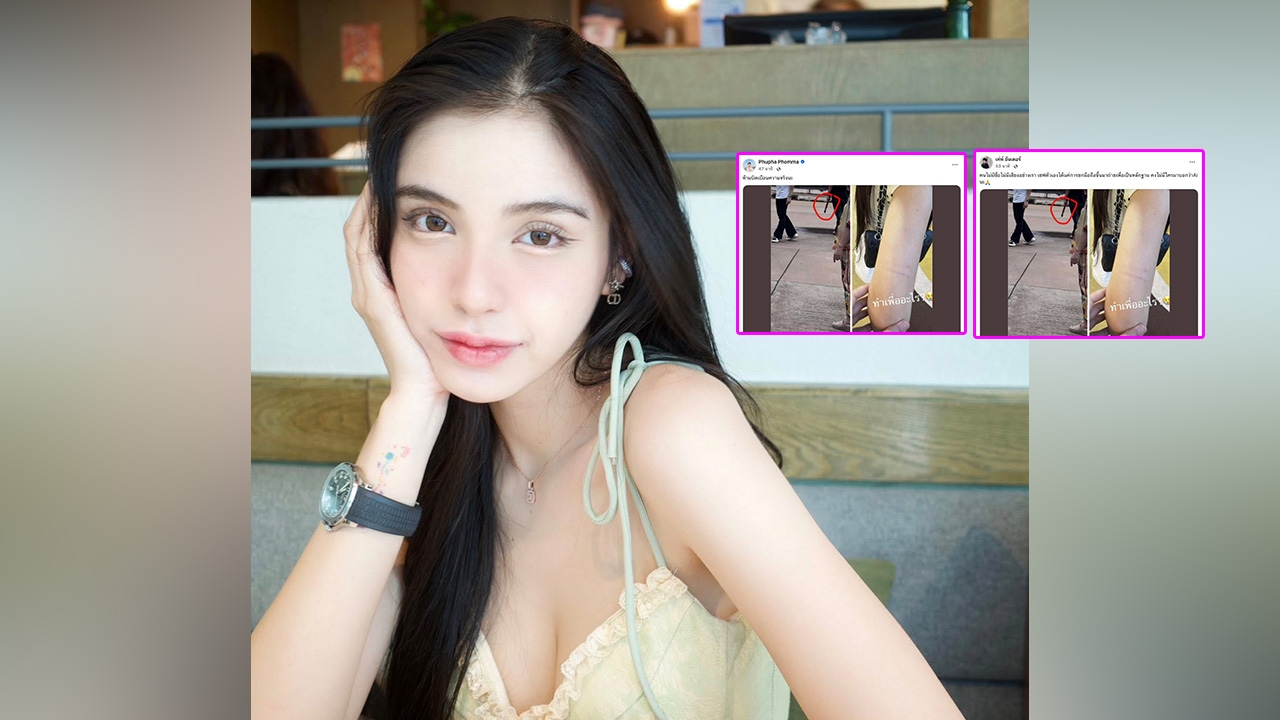 เกิดอะไรขึ้น? คนสนิท "ขนม ศศิกานต์" อดีตภรรยา "ครูเต้ย อภิวัฒน์" แชร์ภาพผู้หญิงมีบาดแผล