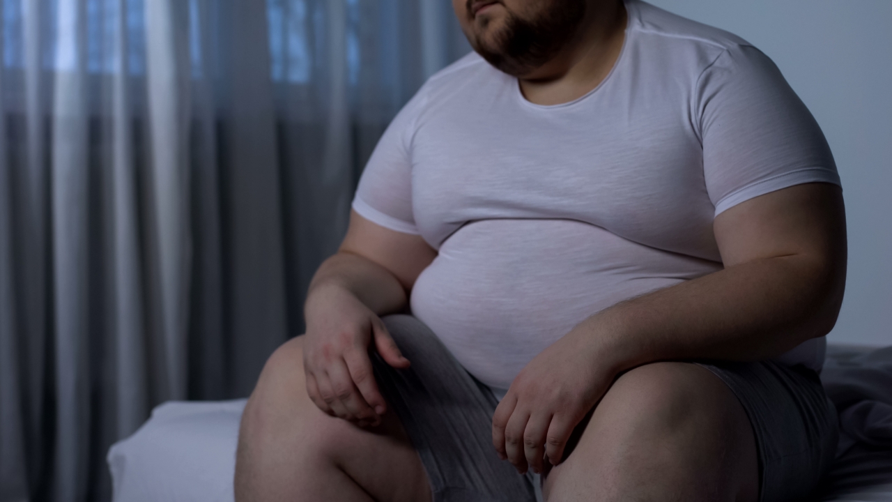 เปิดลิสต์โรงพยาบาลรักษาโรคอ้วนระดับรุนแรง ประกันสังคมฟรี