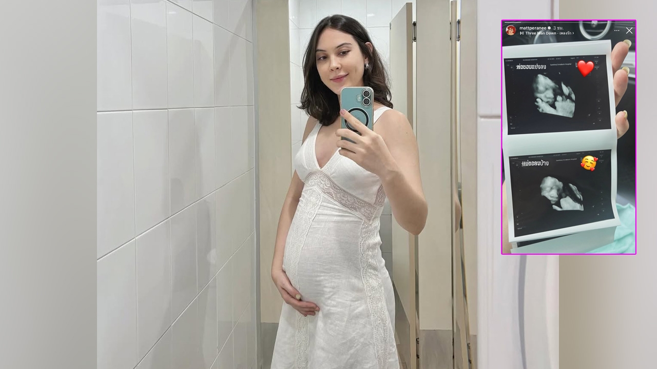 แมท ภีรนีย์ เปิดภาพอัลตราซาวนด์ลูกชายครั้งแรก หน้าตาน่ารักน่าเอ็นดูมาก