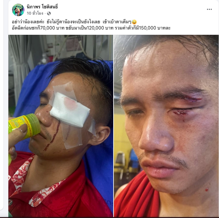 อันตรายมาก เปิดวินาที "นักมวยไทย" โดนฟันศอกเข้าเบ้าตา-หัวหน้าค่าย เผย ไม่รู้ตาจะเป็นยังไง (คลิป)
