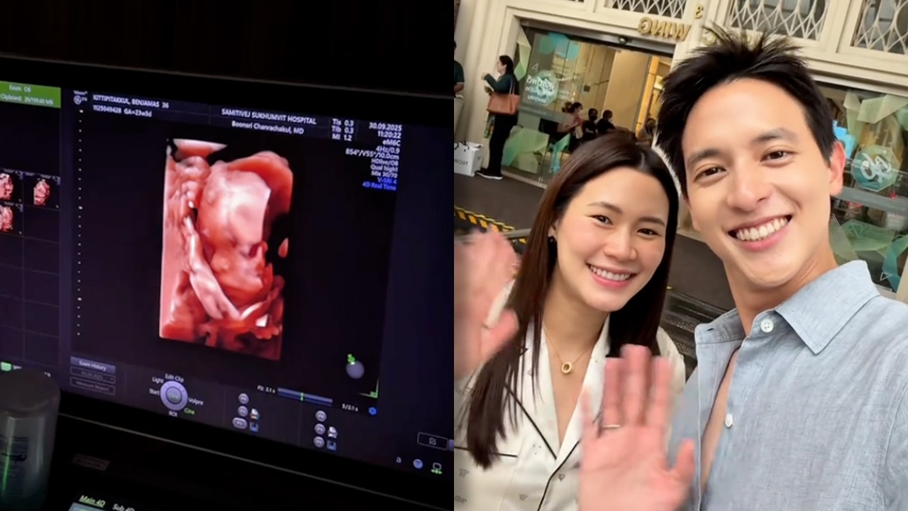เจมส์ จิรายุ เปิดภาพอัลตราซาวนด์หลัง โฟม ท้อง 23 สัปดาห์ แฟนๆ แห่คอมเมนต์ (คลิป)