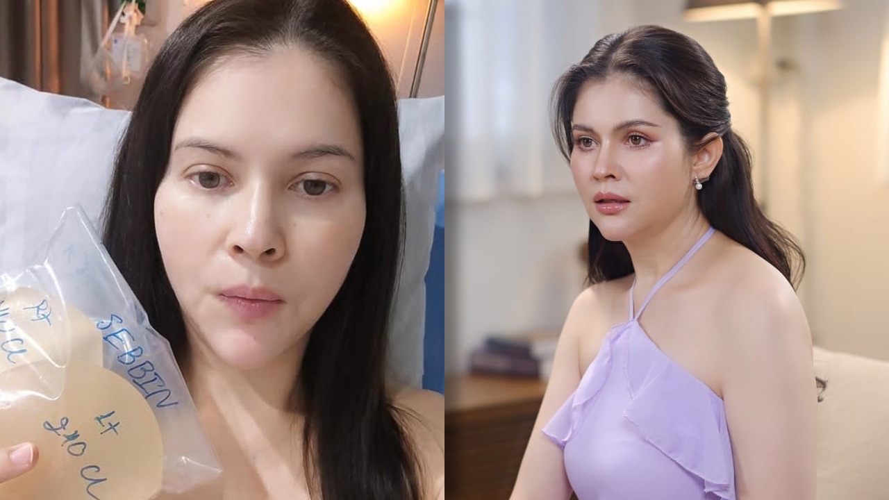 แอนนี่ บรู๊ค ผ่าตัดถอดซิลิโคนหน้าอกออก หลังอยู่ในตัวนาน 20 ปี พร้อมเผยเหตุผล